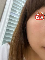 体验前-坤如玛丽·医疗美容中心