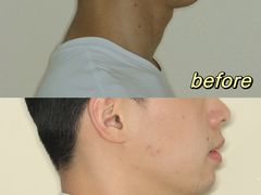 -极光口腔·矫正种植修复(锦江店)