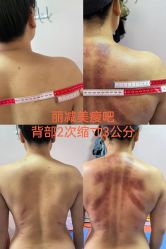 -丽减美瘦吧·减肥瘦身