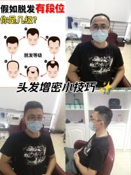 -唐风采假发补发定制