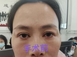 -八大处整形