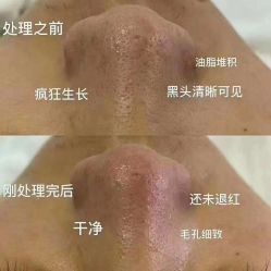 -痘庄科学祛痘国际连锁