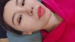 点击看大图 -小忠丽格医美