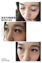 睫毛嫁接-光SPA科技美肤