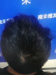 -雍禾植发全国连锁