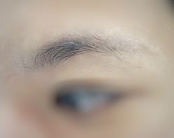 体验前-深圳美莱医疗美容医院