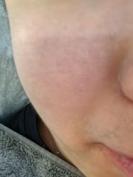 -VE专注问题肌·赛诺龙&科学美肤中心