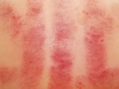 -左悦·艾灸调理·推拿按摩·精油SPA(卓悦汇店)