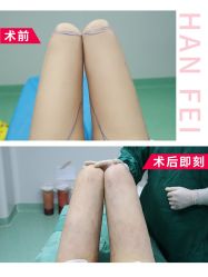 -广东韩妃整形外科医院