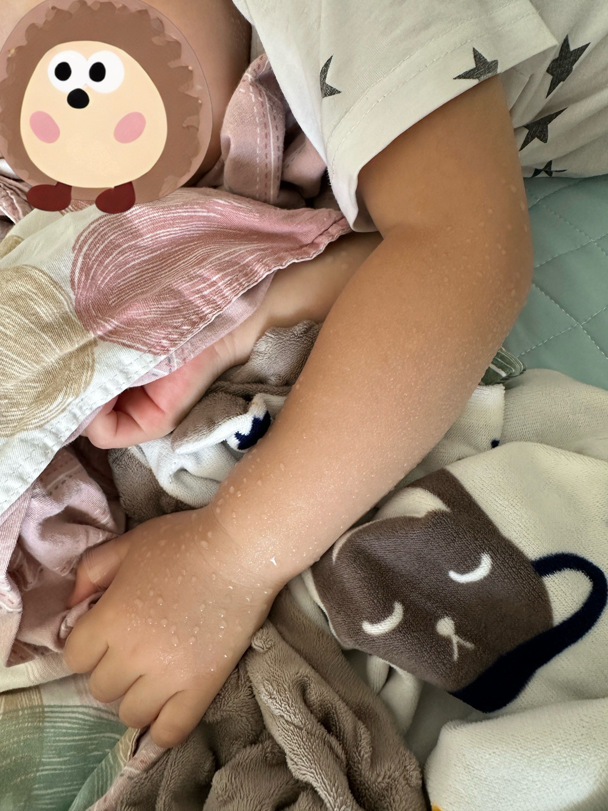 小朋友午睡手臂都是汗,是为啥?