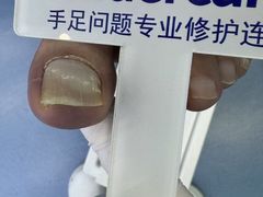 -Andrew指甲专科灰指甲·甲沟炎矫正·3D步态矫形鞋垫定制(浦三路店)