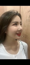 体验后-禾美嘉医疗美容