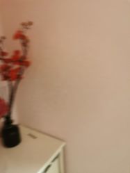 -薇兰专业脱毛连锁机构