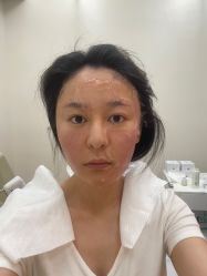 体验后-BR光电保养