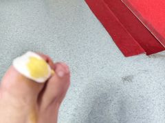 -新甲连锁灰指甲·甲沟炎·鸡眼(黑龙江路店)