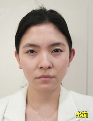 -上海时光整形外科医院