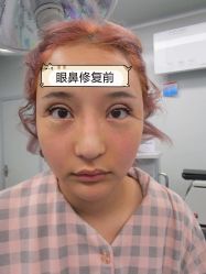 -素美医疗美容·西南眼鼻整形·修复基地