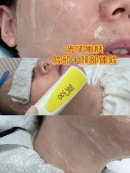 体验前-轻辰医美