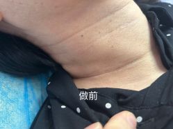 -美丽人生祛斑扁平疣汗管瘤中心