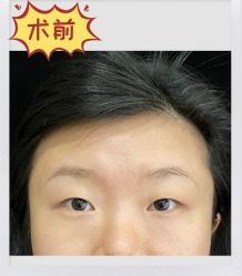 -素美医疗美容·西南眼鼻整形·修复基地