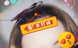 -大麦微针植发全国连锁