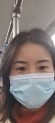 体验后-依萱绮医疗美容