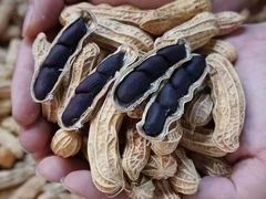 -浙江大学医学院附属第一医院(庆春院区)