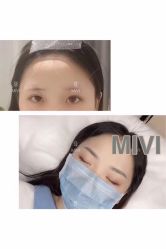 -MIVI半永久纹眉纹绣