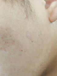 -蕾特恩专业祛痘·皮肤管理