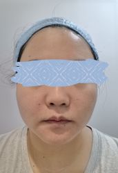 -深圳鹏爱悦心医疗美容医院