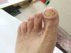 -郑远元专业修脚房(栖山路店)