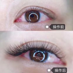 -MLP美丽派·问题肌疗愈中心