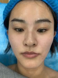 体验后-瑞鑫创美·高定轻医美