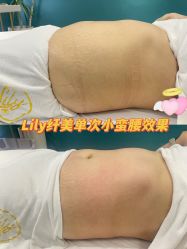 -Lily纤美·科技减脂中心