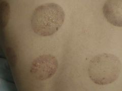 -永太盲人按摩(宝安店)