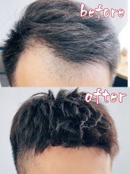 -型男帮男士假发补发·佩戴式发型