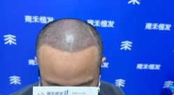 -雍禾植发全国连锁