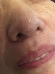 -杉惠素颜美妆皮肤管理中心