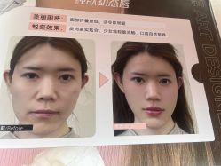 -Yestar艺星医疗美容医院