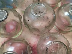 -沈师傅盲人按摩工作室(密三小区店)