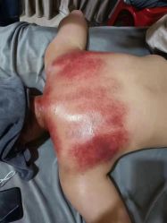 -良咔瘦身·减脂塑形