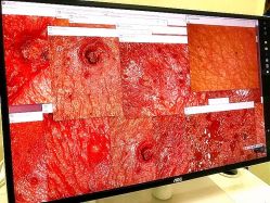 -痘博士天津·全国连锁祛痘机构