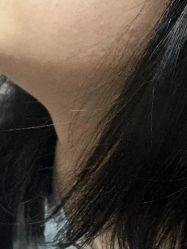 -美瑞莎创美医疗美容