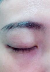 -紫洁俪方（北京）医疗美容