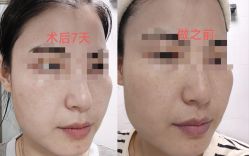 -彼家美创·量肤定制修护管理