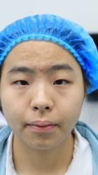 体验前-上海伊莱美医疗美容医院
