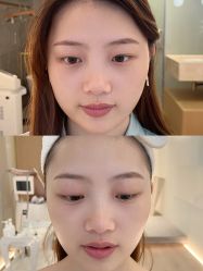 -HYOUNG 禾漾·BTL官方美学中心