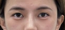 -Yestar重庆艺星医疗美容医院