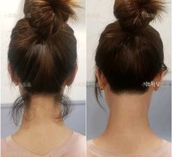 点击看大图 -小梨·OndaPro·专业脱毛连锁机构