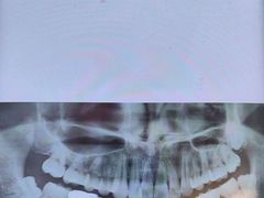 -土豆口腔(凤凰北总店)